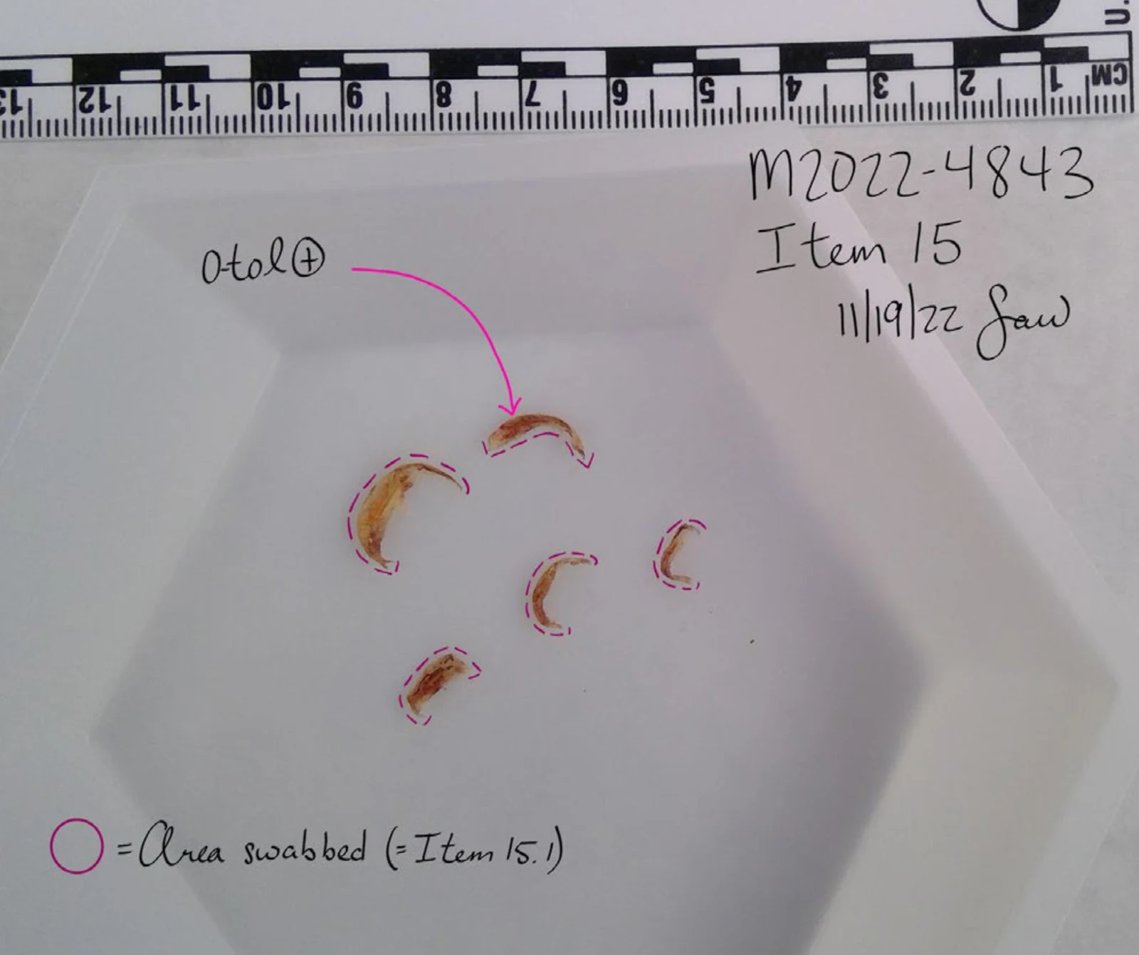 Five small curved clippings in a white tray below a measurement scale, outlined in pink with swab-area annotations and item 15.