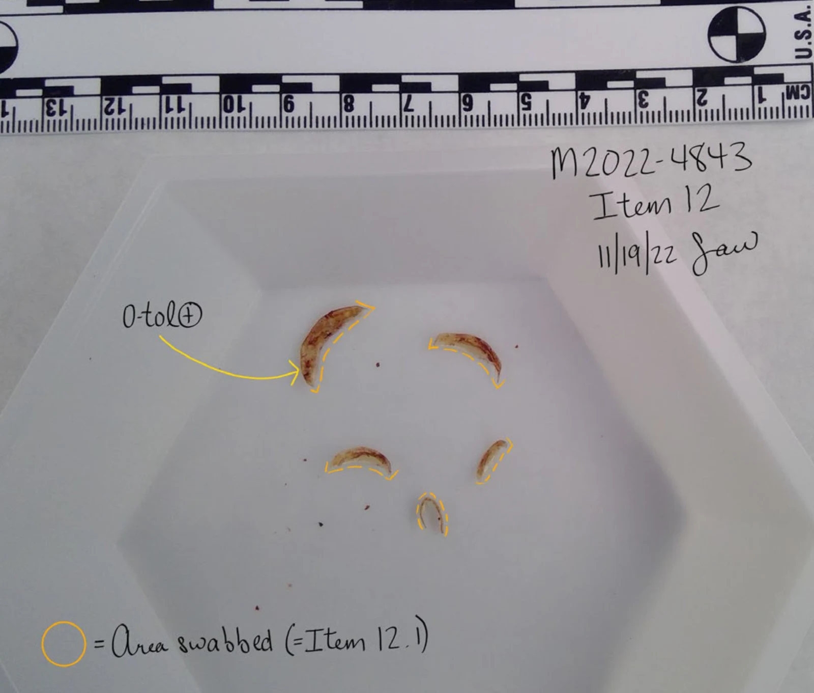 Five curved clippings in a white tray beneath a measurement scale, outlined in yellow with swab-area annotations and item 12.