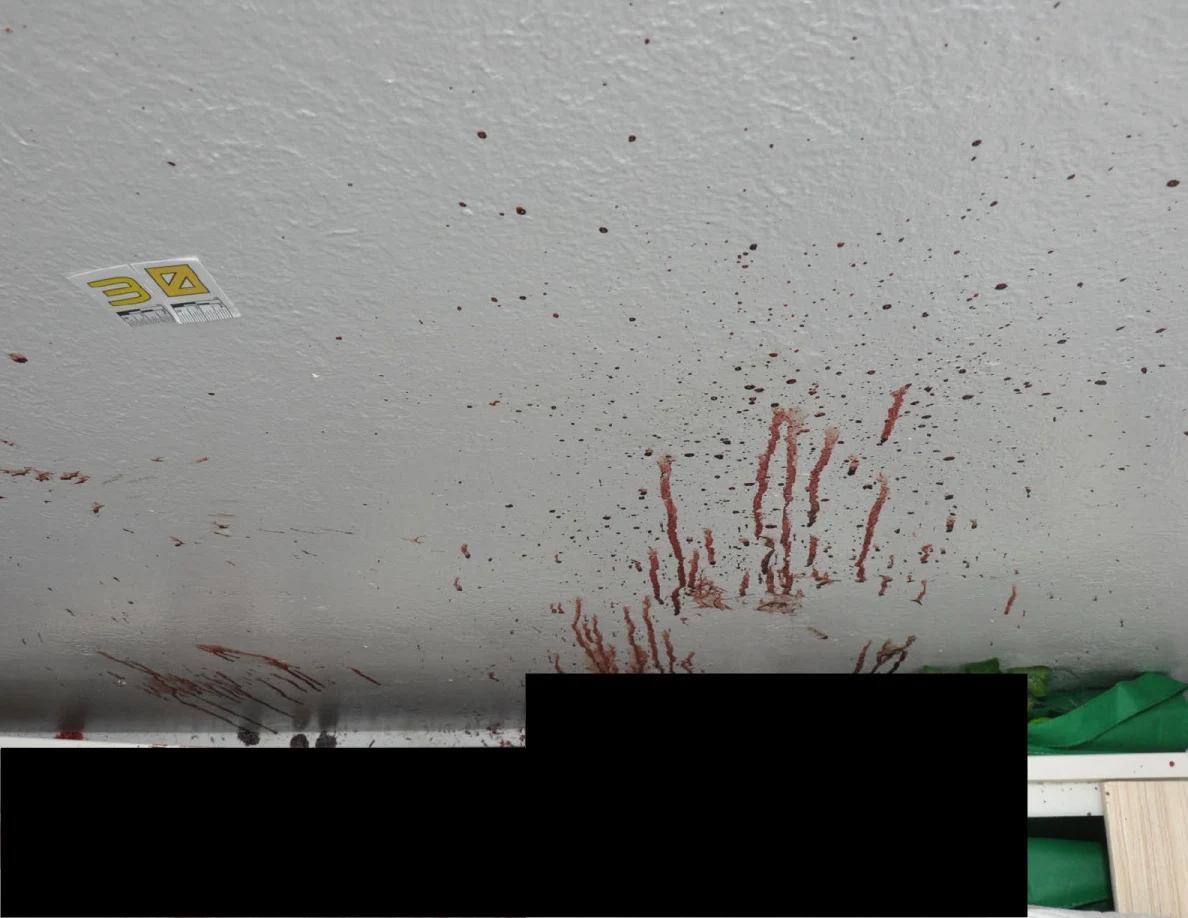 Reddish wall streaks above partly redacted bed rails.