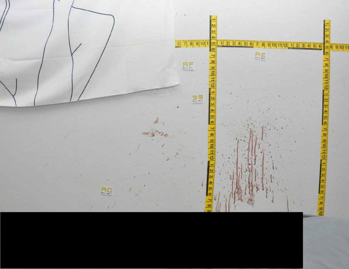 Wall spots and streaks below a fabric hanging beside labels and measuring tapes, with a black redaction below.