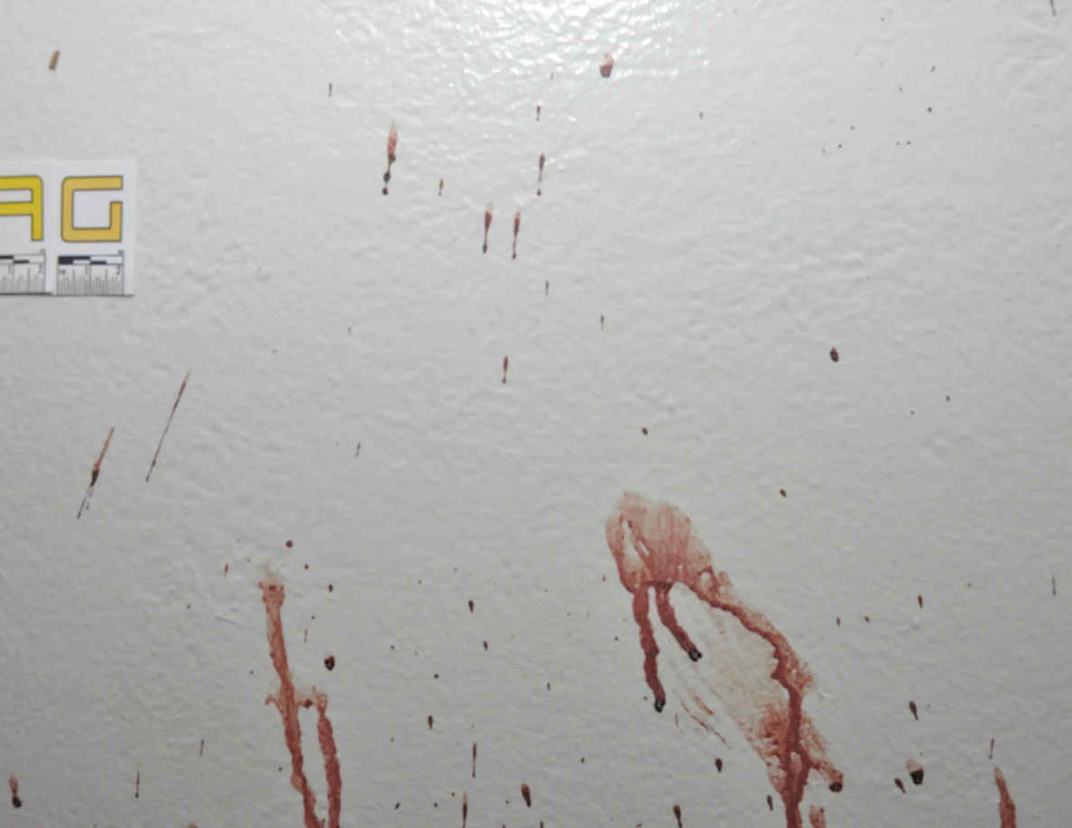 Reddish smears and streaks beside partially visible label AG.