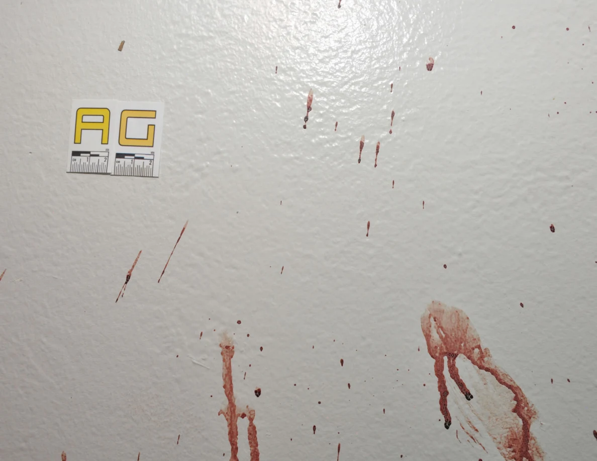Reddish wall smears and downward streaks below label AG.
