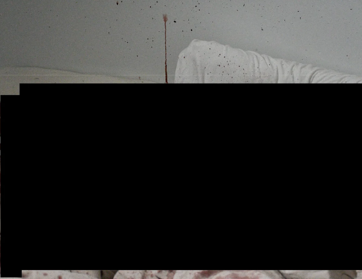 Pillow edge and reddish wall streak above a large black redaction.