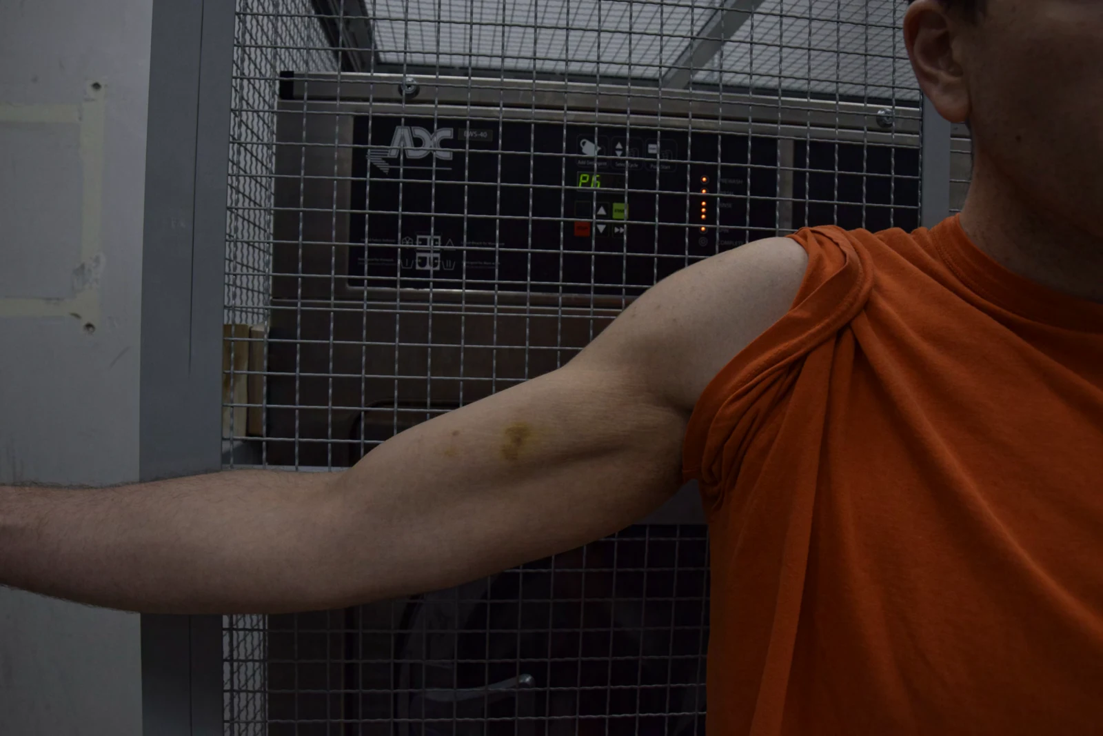 Outstretched bare upper arm and shoulder beside orange clothing, photographed against a metal mesh equipment enclosure.