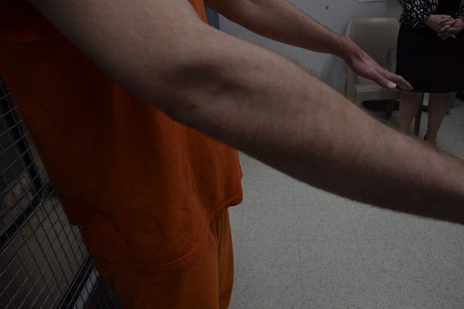 Closer oblique view of an extended arm and elbow, with the other arm extending behind it and orange clothing at the side.