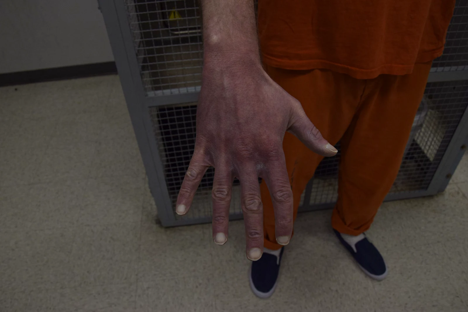 Downward view of the back of a hand with spread fingers; orange trousers and blue slip-on shoes are visible below.