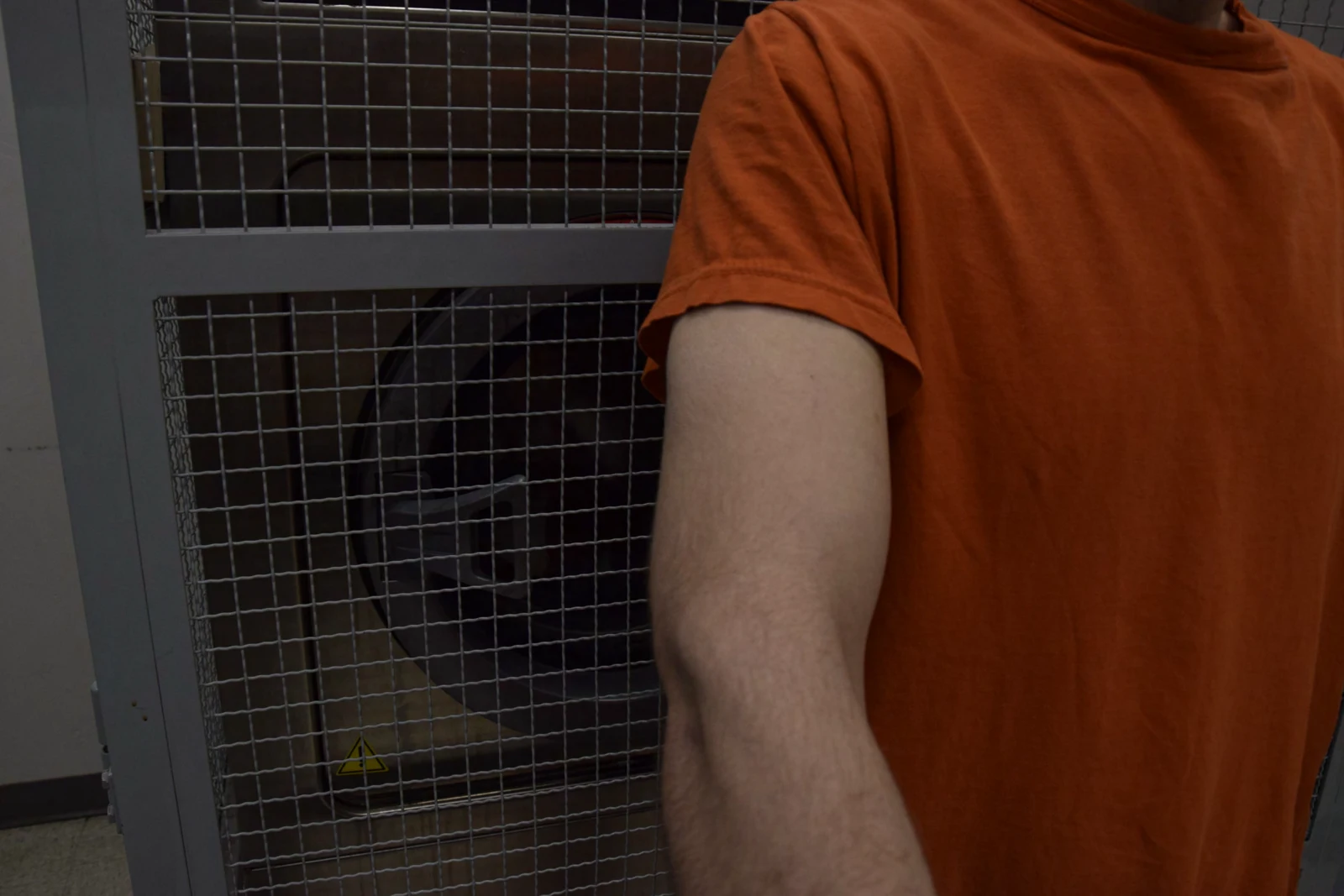 Close frontal view of an exposed upper arm and elbow below an orange sleeve, against gray metal mesh.