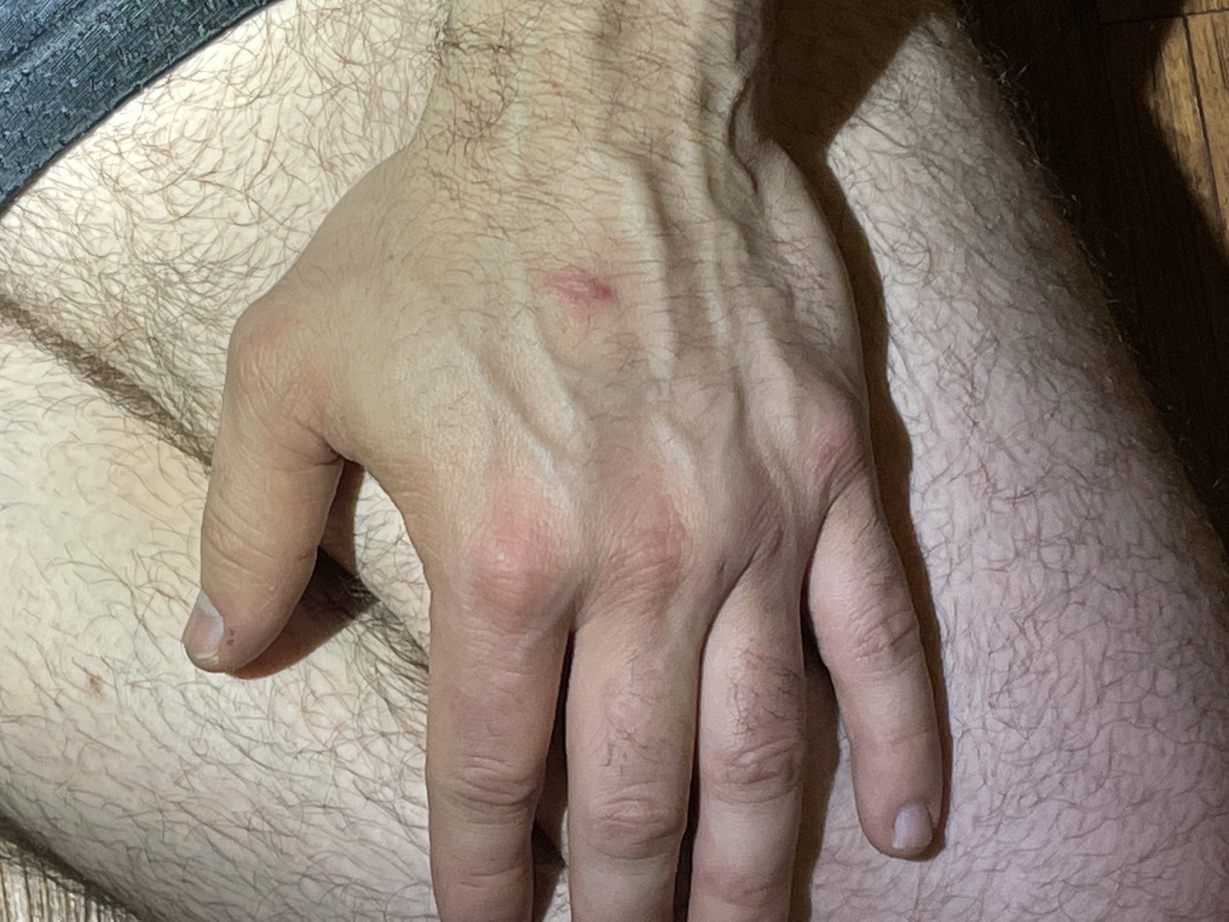22-M10246 Domestic Dispute — Left Hand.JPG.jpg