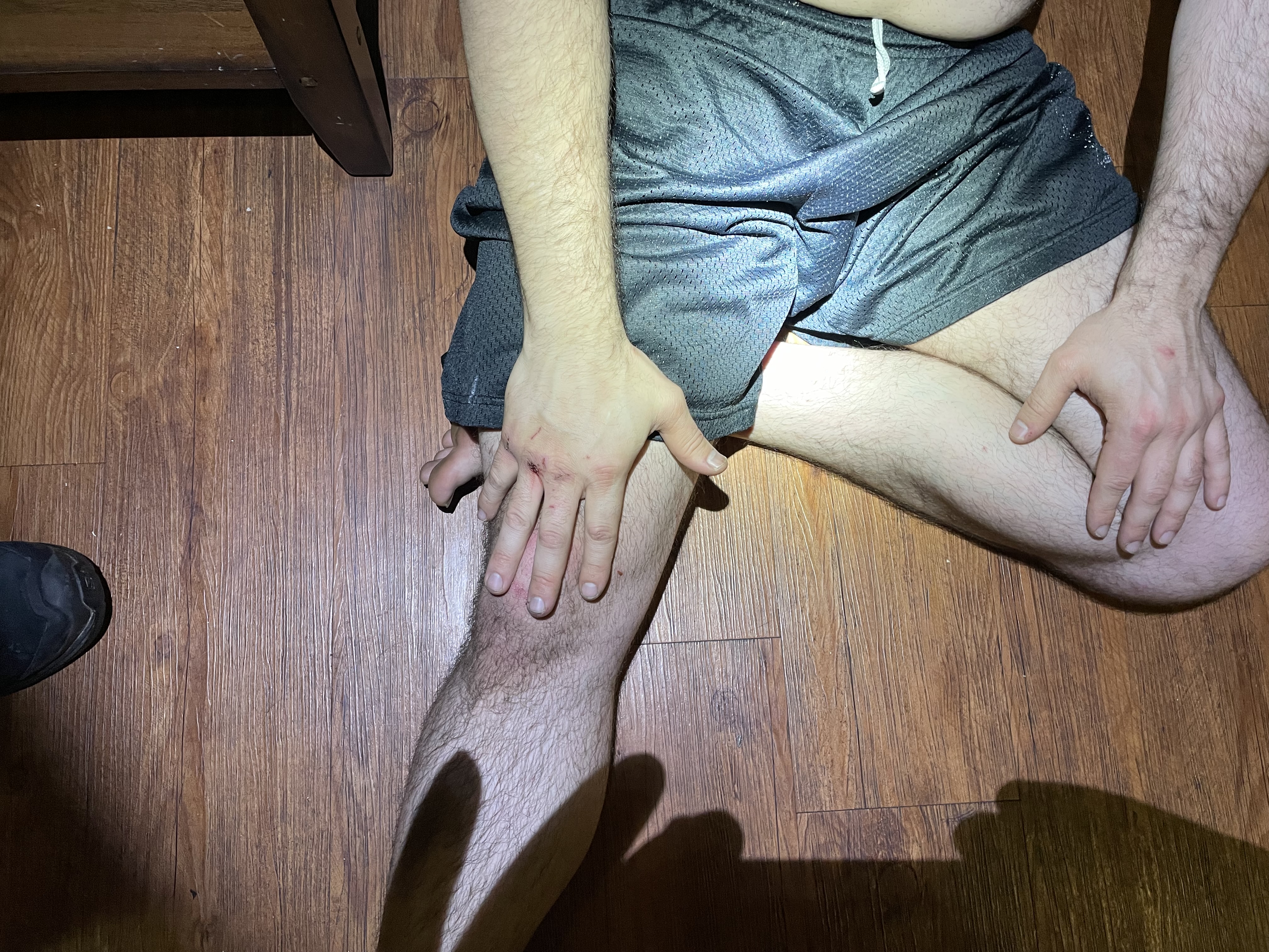 22-M10246 Domestic Dispute — Hands.JPG.jpg