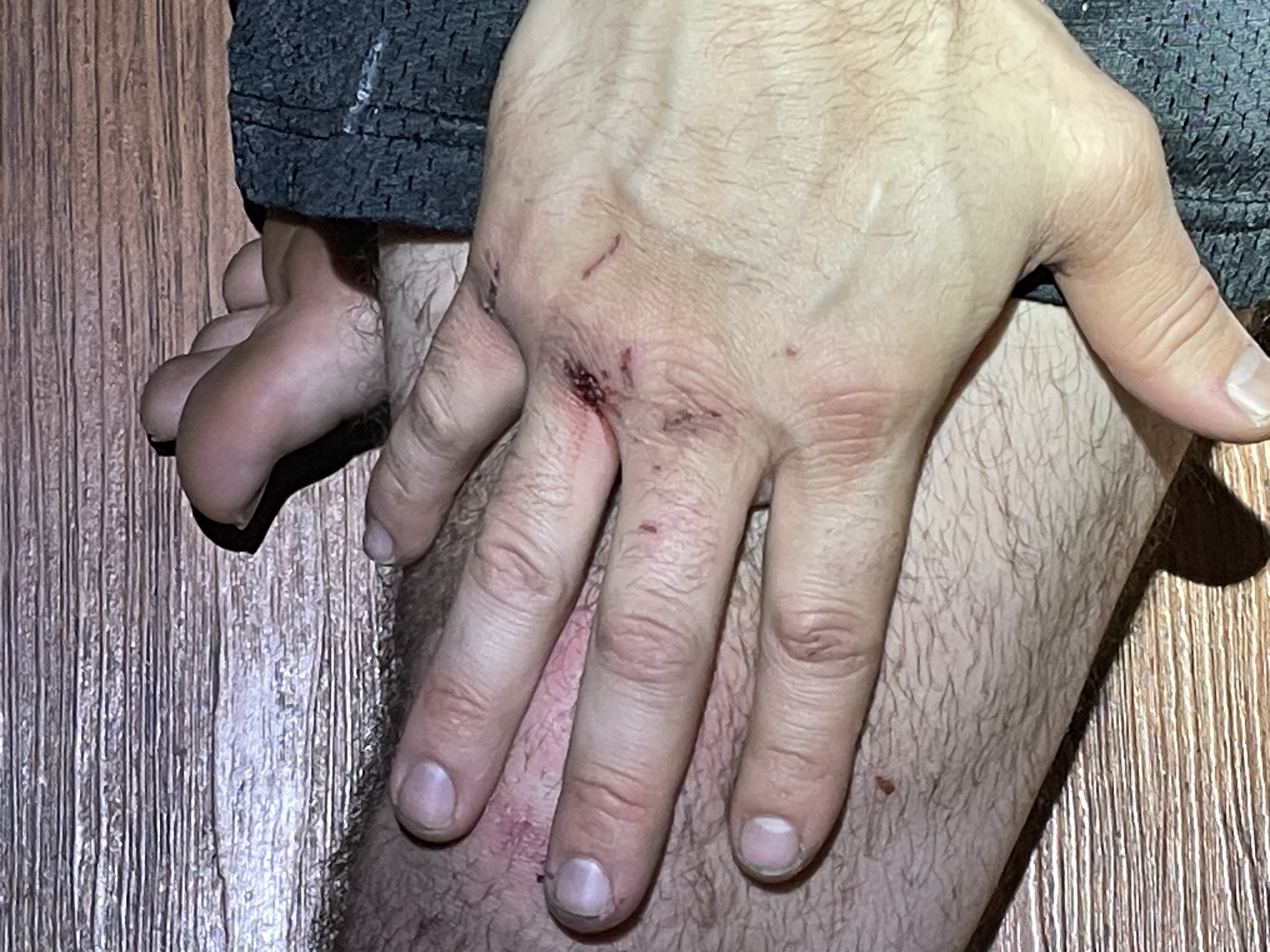 22-M10246 Domestic Dispute — Right Hand.JPG.jpg